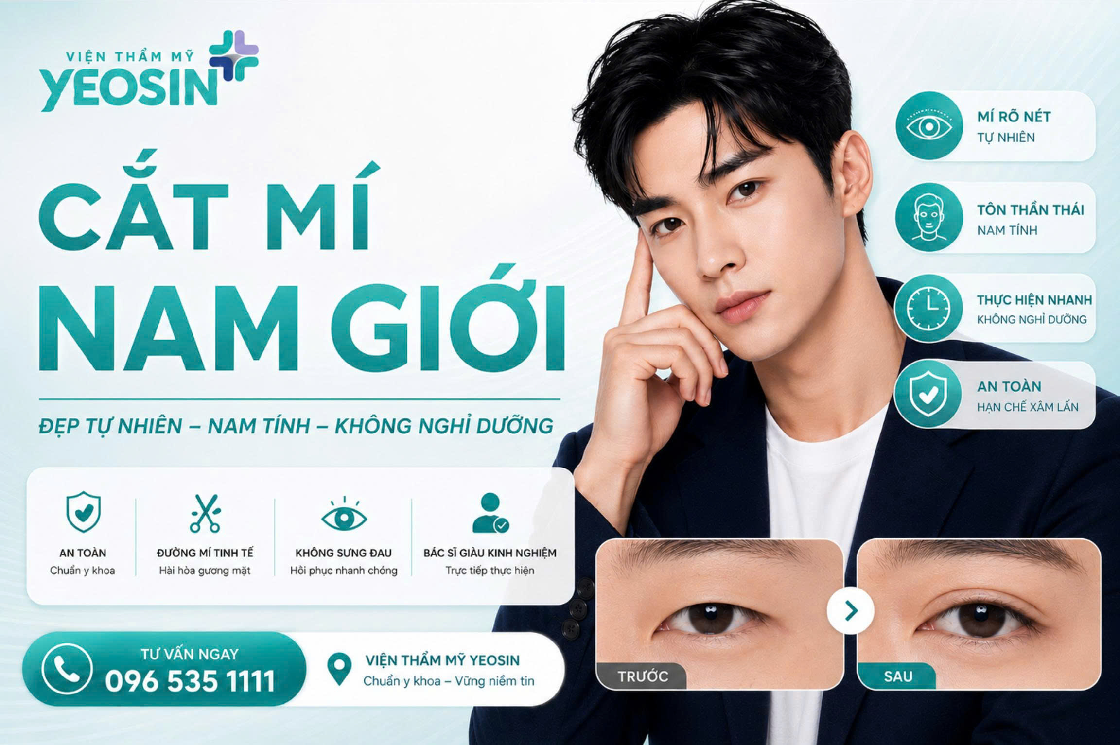 Cắt mí nam giới và những điều cần biết.