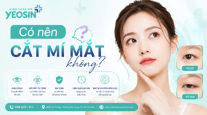 Có nên cắt mí mắt không? Lời khuyên từ chuyên gia
