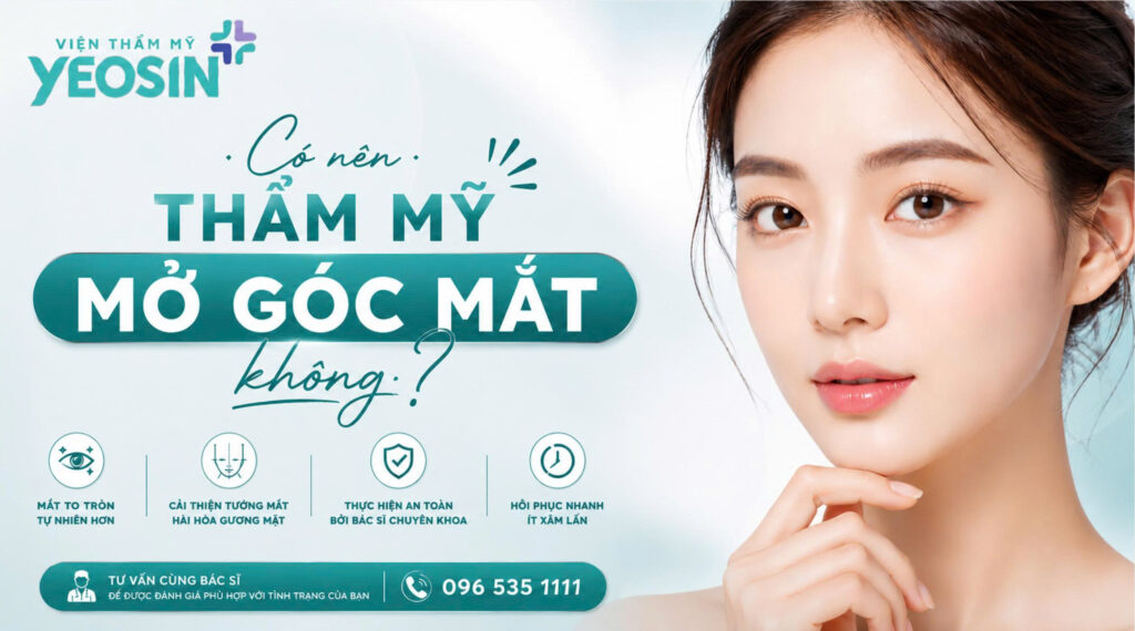 Có nên thẩm mỹ mở góc mắt không?