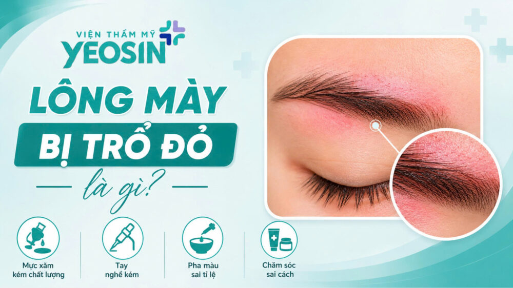 Lông mày bị trổ đỏ: Nguyên nhân và cách xóa chân mày trổ đỏ