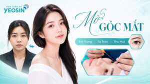 Mở góc mắt - Phẫu thuật mở rộng góc mắt