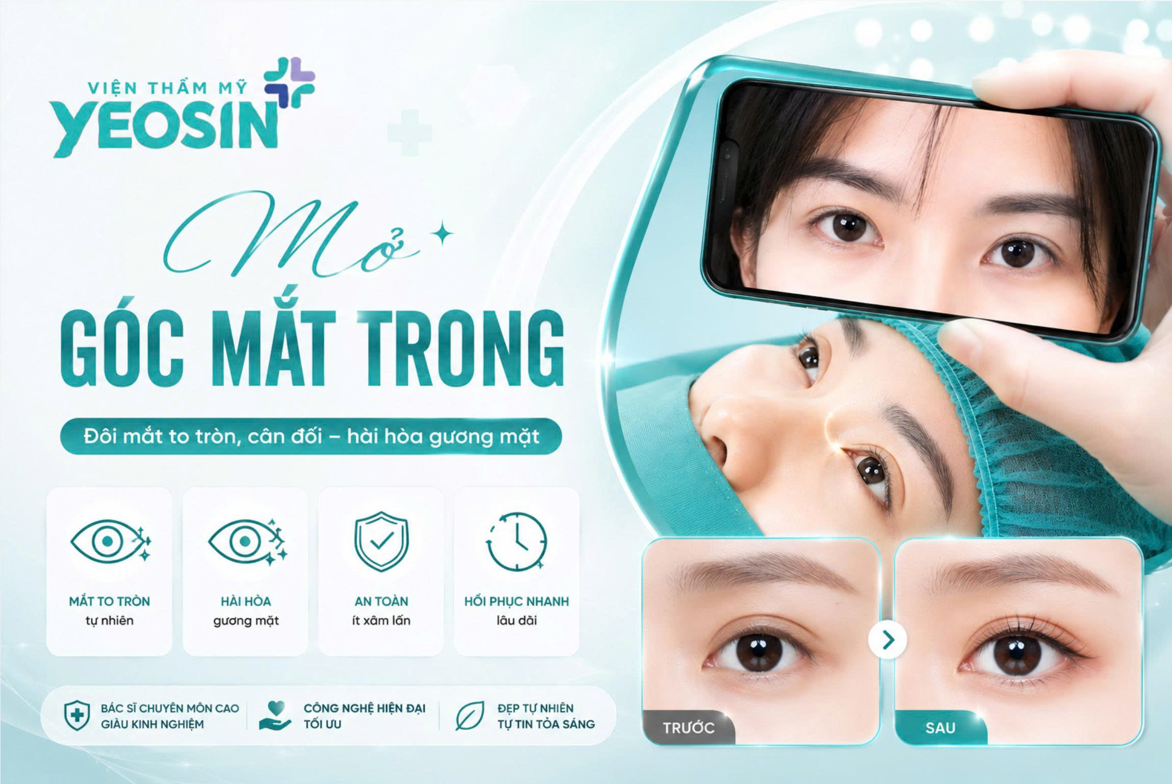 Thẩm mỹ mở rộng góc mắt trong cho đôi mắt đẹp to tròn