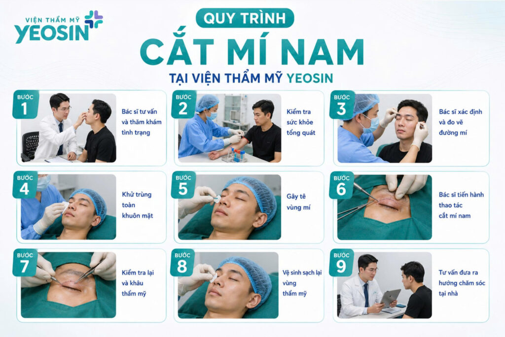 Cắt mí nam giới và những điều cần biết. 9 Quy trình cắt mí nam tại Viện Thẩm Mỹ Yeosin