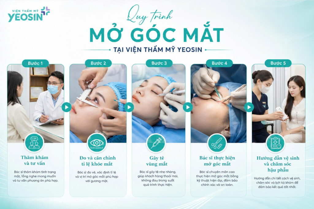 Quy trình thực hiện thẩm mỹ mở rộng góc mắt trong.