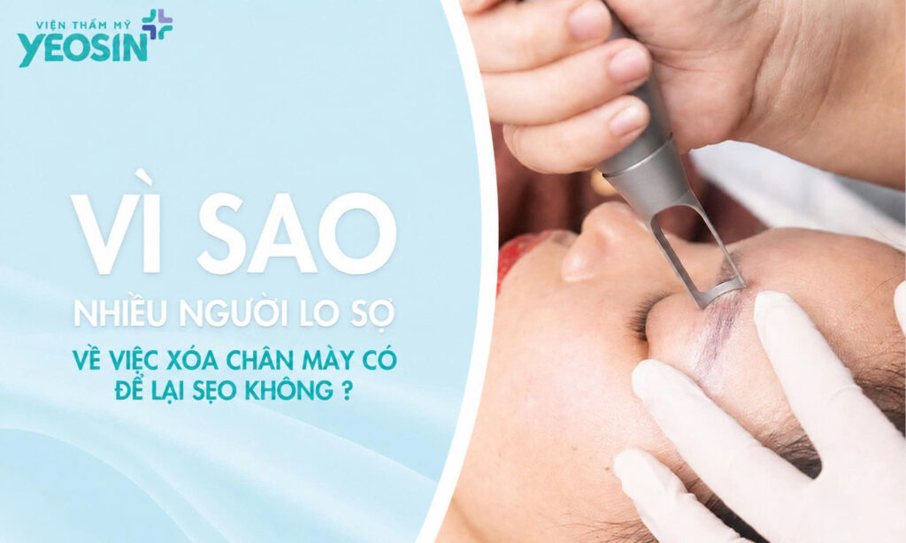 Xóa xăm chân mày có để lại sẹo không? Xóa lông mày có đau không? 6 Vì sao xóa xăm chân mày có để lại sẹo không là lo lắng của rất nhiều người?