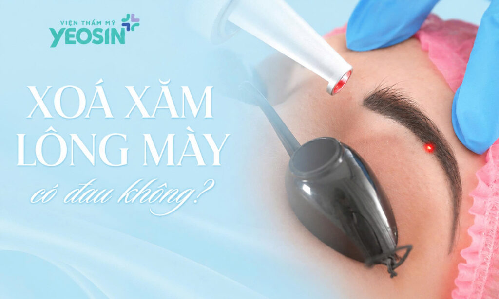 Xóa xăm chân mày có để lại sẹo không? Xóa lông mày có đau không? 8 Xóa lông mày có đau không?
