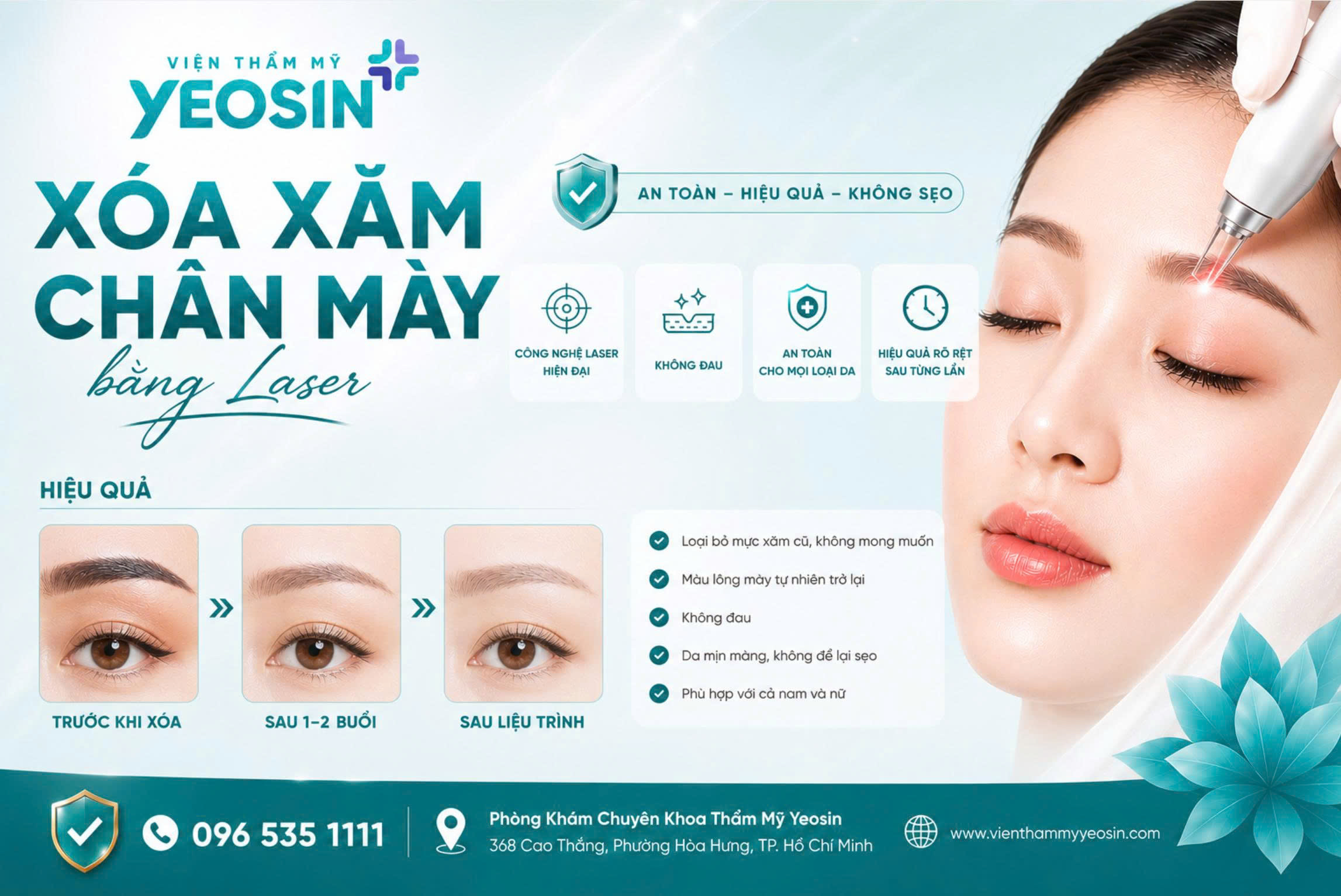 Xóa chân mày bằng laser có hết không?