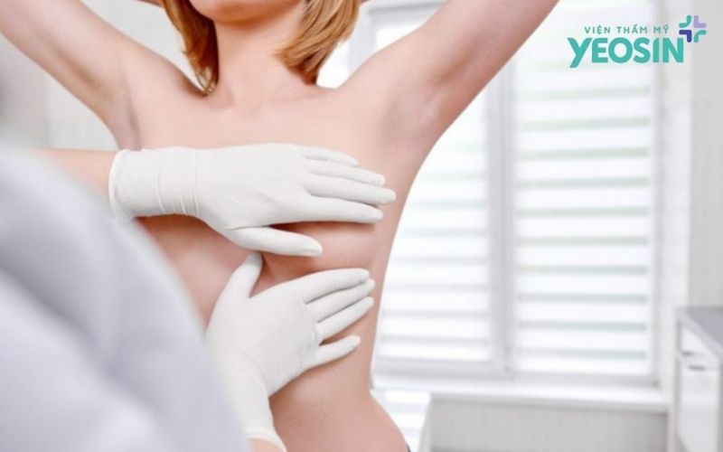 Chăm sóc vùng nhũ hoa sau khi làm hồng