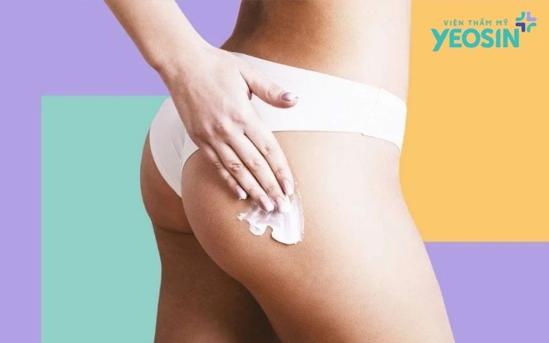 Thâm mông: Nên chăm sóc tại nhà hay điều trị chuyên sâu? 7 Cách cải thiện thâm mông tại nhà và những điều cần lưu ý