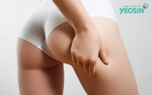 anh Yeosin 4 1