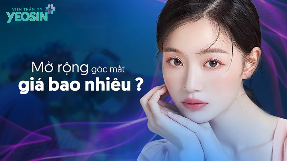 Chi phí mở rộng góc mắt bao nhiêu tiền là hợp lý?