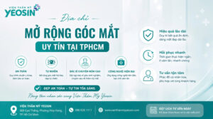 Top 6 địa chỉ mở rộng góc mắt uy tín tại Tphcm