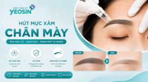 Top 3 phương pháp hút mực xăm chân mày phổ biến hiện nay