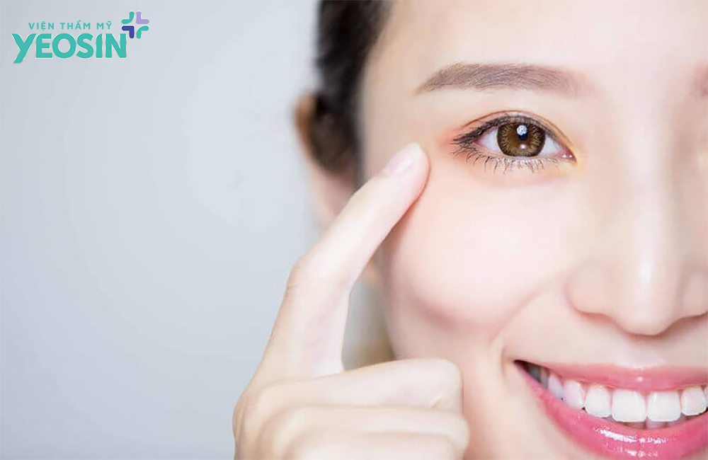 Phẫu thuật mở góc mắt ngoài là gì?