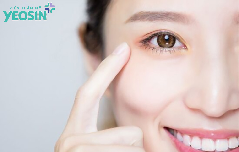 Mở góc mắt - Phẫu thuật mở rộng góc mắt 6 Những lưu ý quan trọng khi mở rộng góc mắt bạn cần biết
