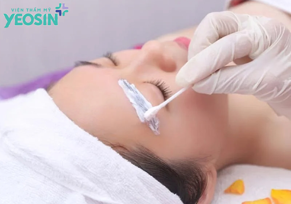 Một số lưu ý khi xóa xăm chân mày bằng dung dịch