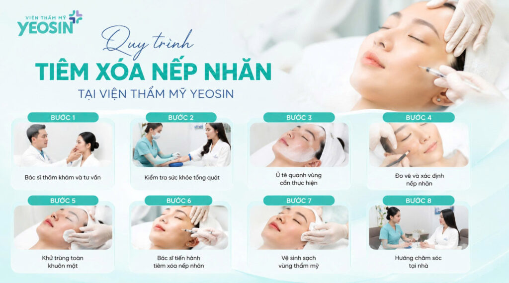 Tiêm xóa nếp nhăn - Phương pháp xóa nhăn hiệu quả 13 Quy trình tiêm xóa nếp nhăn tại Viện Thẩm Mỹ Yeosin