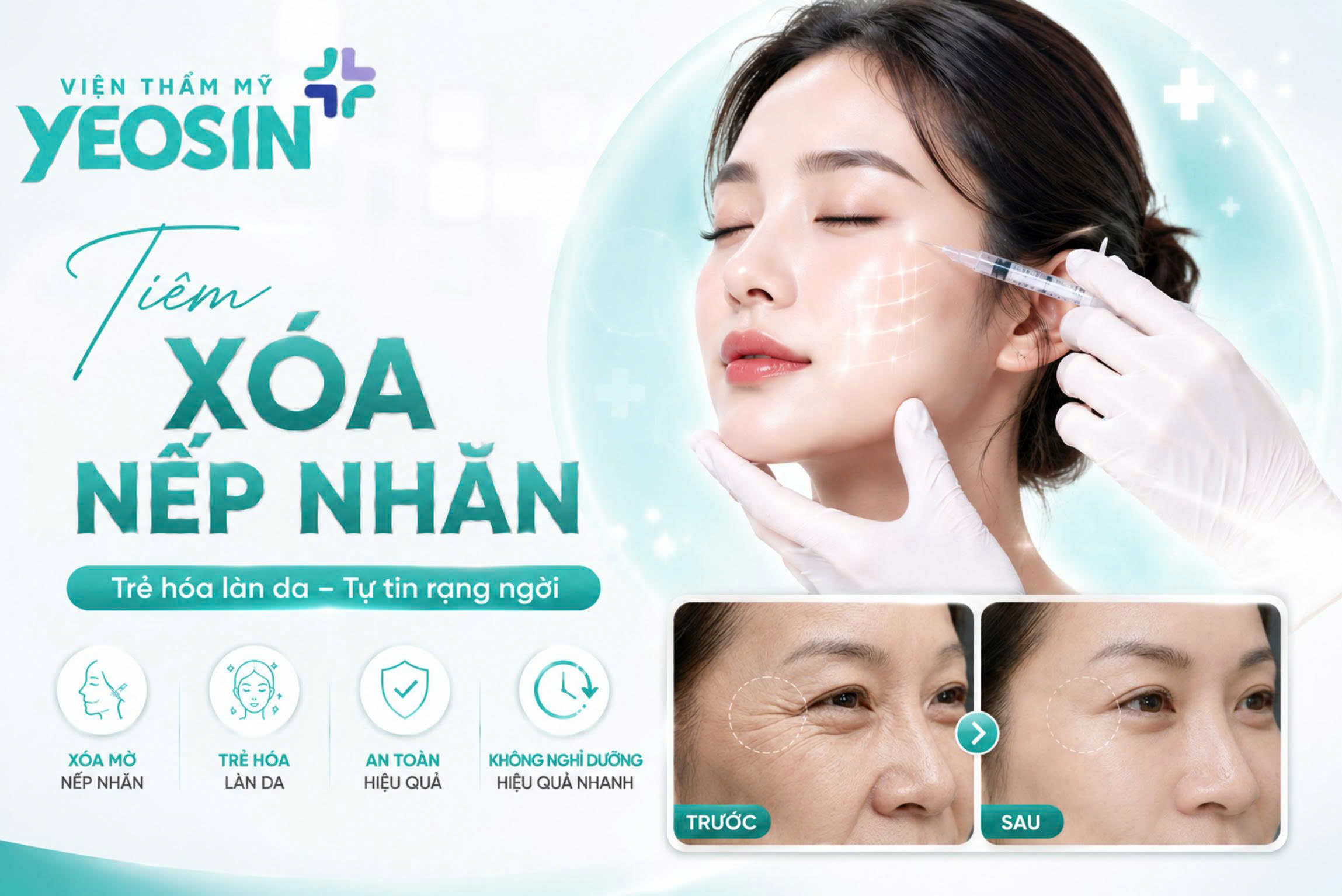 Tiêm xóa nếp nhăn - Phương pháp xóa nhăn hiệu quả
