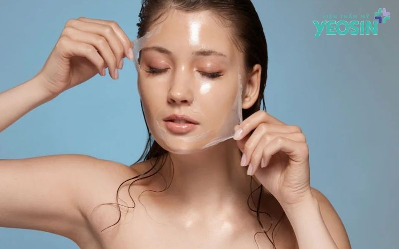 Các phương pháp điều trị sẹo rỗ hiện nay