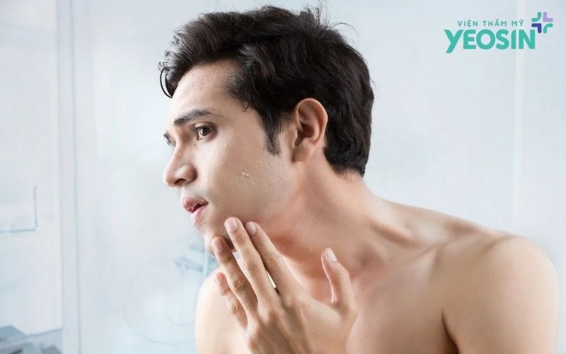 Nam giới có cần skincare không? Quy trình chăm sóc da tối giản 6 Da nam giới khác da nữ giới như thế nào?