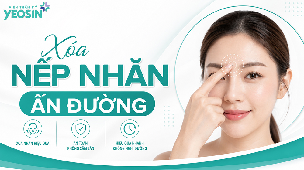 cách xóa nếp nhăn ấn đường