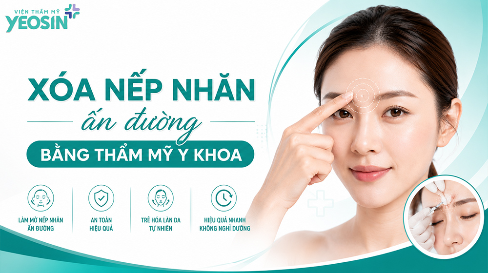 8 cách xóa nếp nhăn ấn đường an toàn và hiệu quả 12 Cách xóa nếp nhăn ấn đường bằng thẩm mỹ y khoa