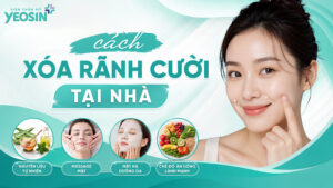 Gợi ý 5+ cách xóa rãnh cười tại nhà hiệu quả