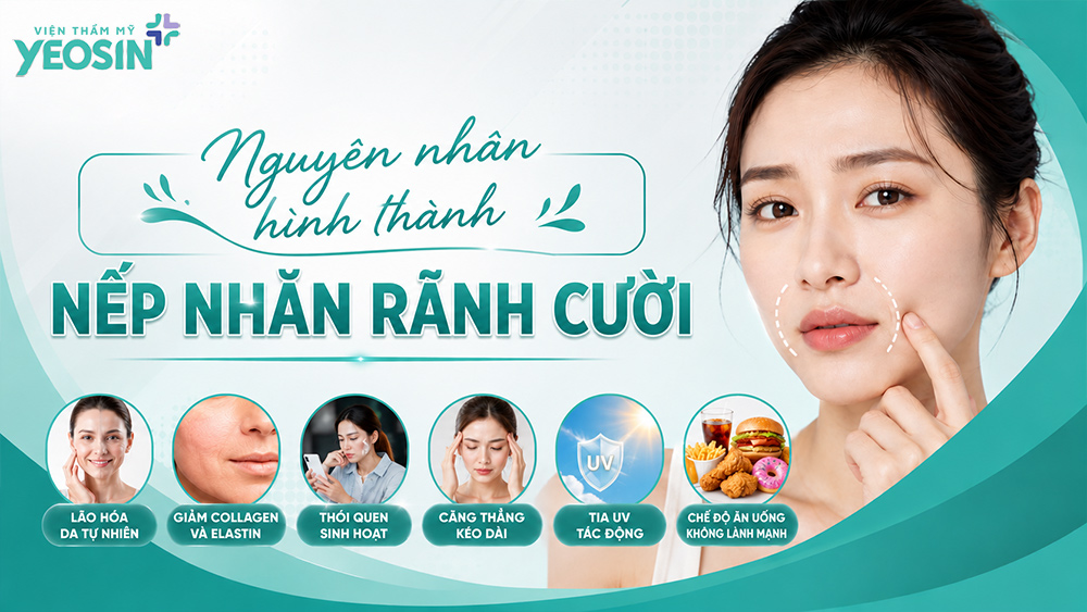 Gợi ý 6+ cách xóa rãnh cười tại nhà hiệu quả 8 Nguyên nhân hình thành nếp nhăn rãnh cười