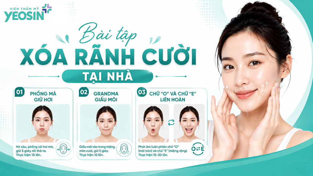 Gợi ý 6+ cách xóa rãnh cười tại nhà hiệu quả 10 Bài tập xóa rãnh cười tại nhà