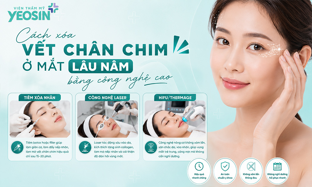 Cách xóa vết chân chim ở mắt lâu năm bằng công nghệ cao