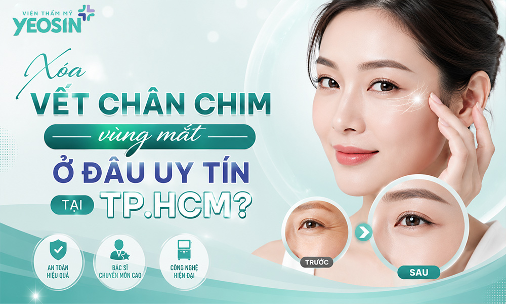 Xóa vết chân chim vùng mắt ở đâu uy tín tại Tphcm?