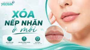 Môi có nhiều nếp nhăn