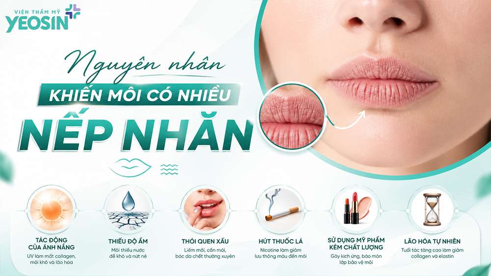 Nguyên nhân khiến môi có nhiều nếp nhăn
