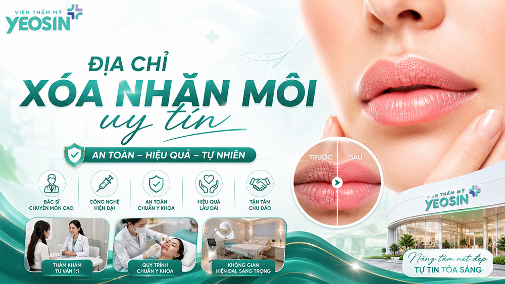 Cách xóa môi có nhiều nếp nhăn bằng thẩm mỹ y khoa