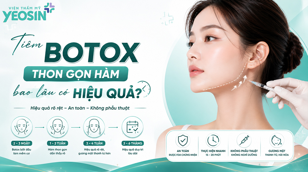 Tiêm botox thon gọn hàm và những điều cần biết 8 Tiêm botox thon gọn hàm bao lâu thấy được kết quả?