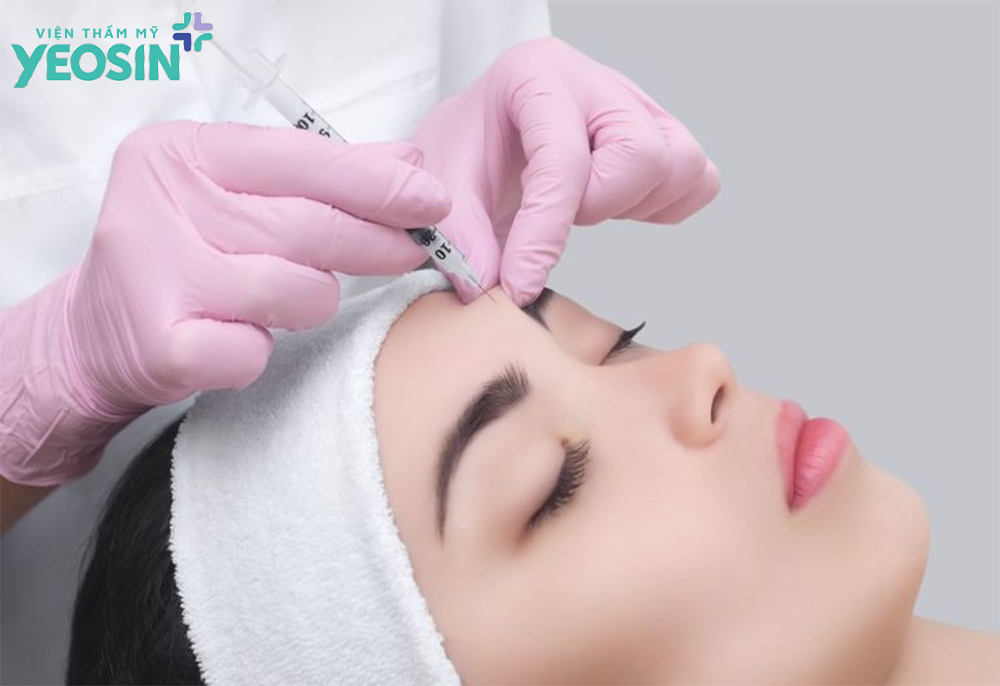 Tiêm botox xóa nhăn trán và những thông tin hữu ích 8 Tiêm botox xóa nhăn trán là gì?