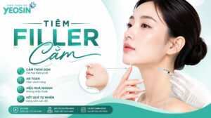 Tiêm filler cằm và những điều cần biết sau tiêm cằm