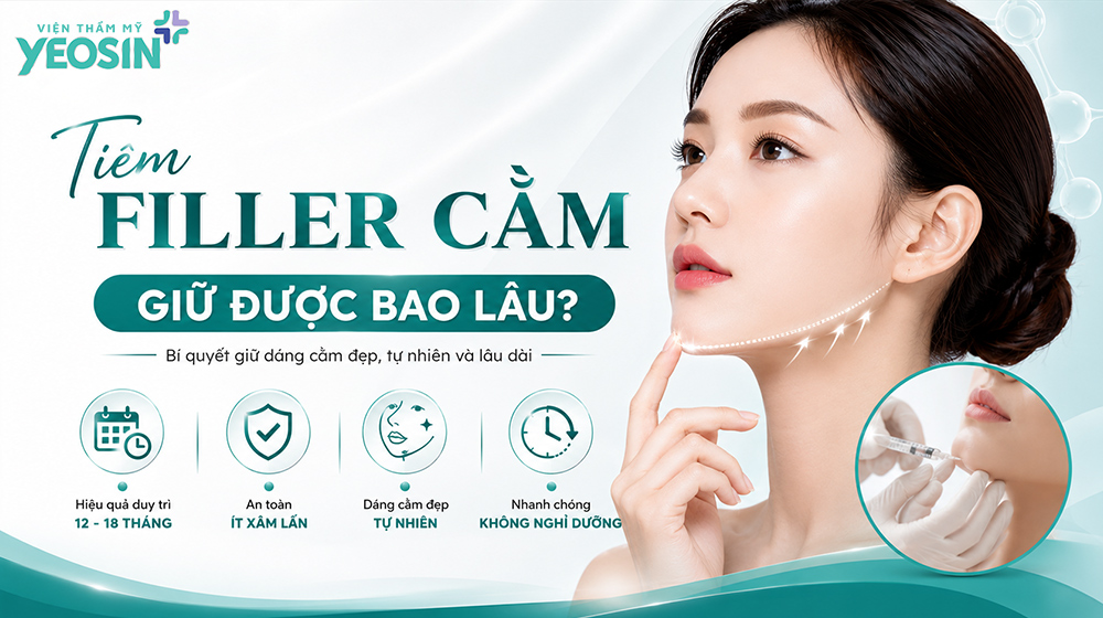Tiêm filler cằm giữ được bao lâu?