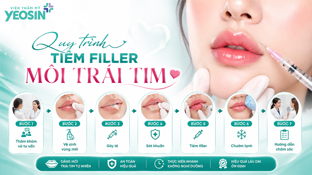Quy trình tiêm filler môi trái tim chuẩn y khoa