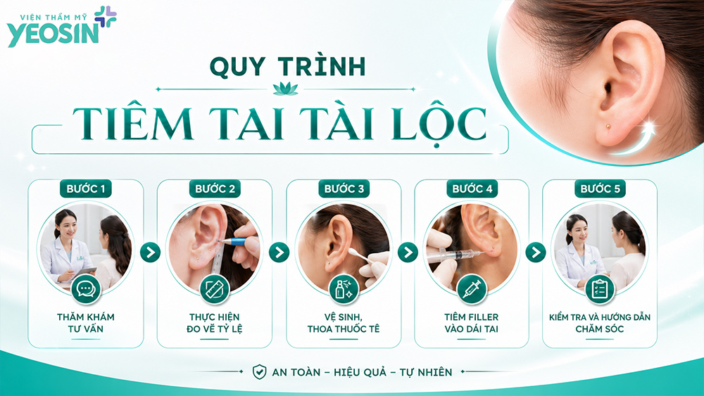 Tiêm tai tài lộc - Xu hướng làm đẹp hot năm 2026 8 Quy trình tiêm tai tài lộc tại Viện Thẩm Mỹ Yeosin