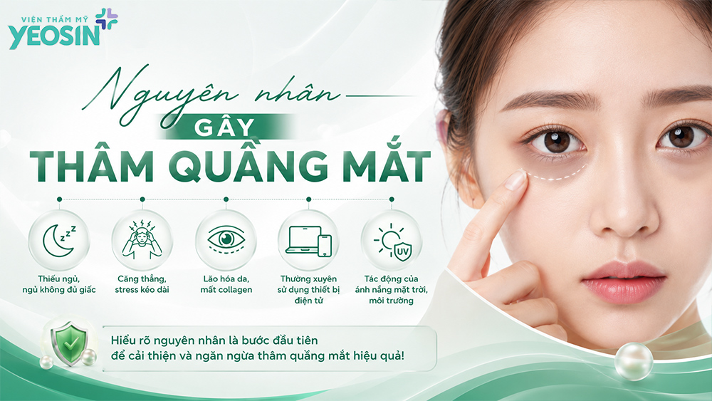 Nguyên nhân gây thâm quầng mắt