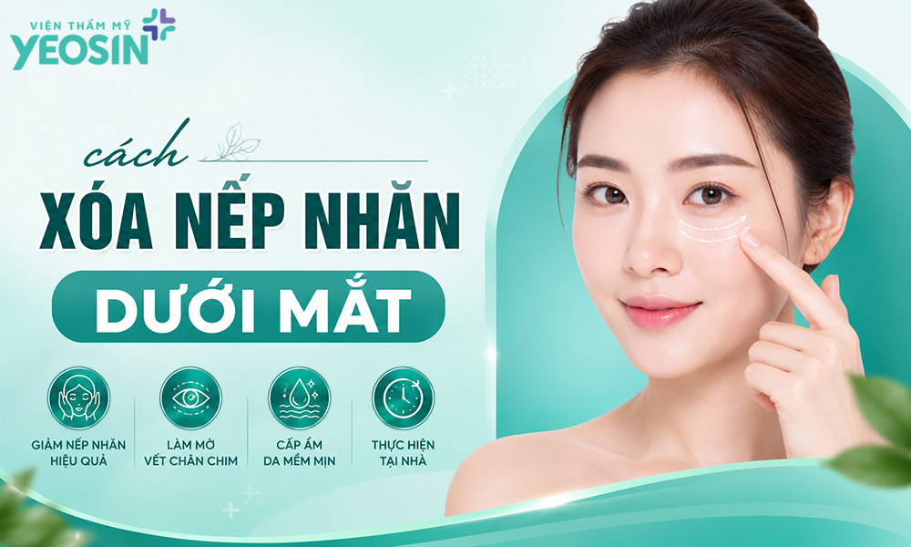 Nếp nhăn dưới mắt: