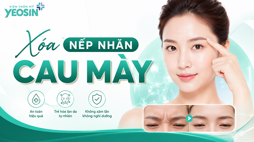 Nếp nhăn giữa 2 chân mày