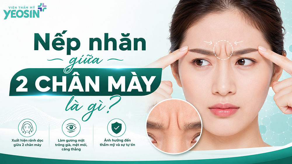 Nếp nhăn giữa 2 chân mày: Nguyên nhân và cách loại bỏ 6 Nếp nhăn giữa 2 chân mày là gì?