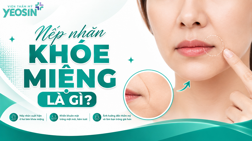 Nếp nhăn khóe miệng: Nguyên nhân và cách xóa nhăn khóe miệng 6 Nếp nhăn khóe miệng là gì?
