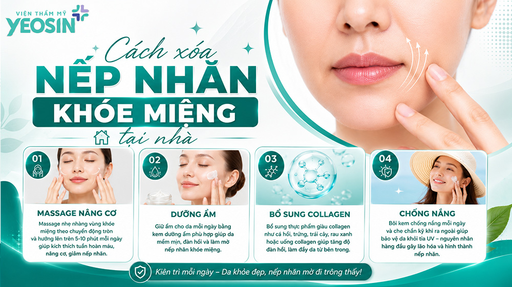 Nếp nhăn khóe miệng: Nguyên nhân và cách xóa nhăn khóe miệng 8 Cách xóa nếp nhăn khóe miệng tại nhà
