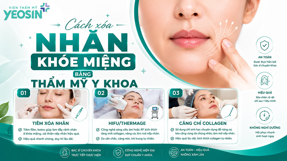 Nếp nhăn khóe miệng: Nguyên nhân và cách xóa nhăn khóe miệng 9 Cách xóa nhăn khóe miệng bằng phương pháp thẩm mỹ