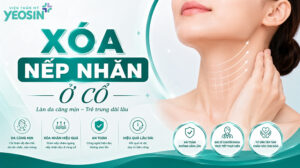 Nếp nhăn ở cổ