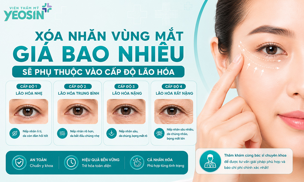 Xóa nhăn vùng mắt giá bao nhiêu sẽ phụ thuộc vào cấp độ lão hóa