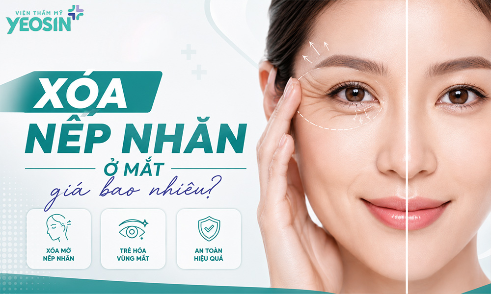 Xóa nhăn ở mắt giá bao nhiêu?